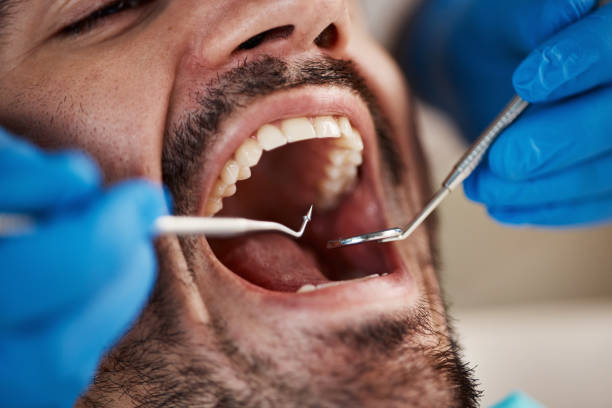 Best Dental Abscess Treatment in Montoursville, PA